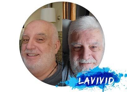 What Are The Pros And Cons Of Toupees