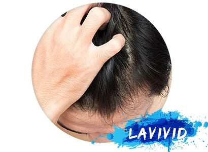 Why Many People would Suffer itching while Wearing A Hair System