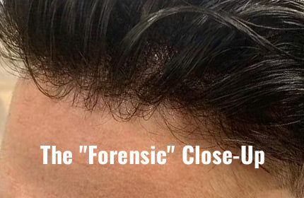 Matte Finish Protocols: Engineering a Truly Invisible Hairline