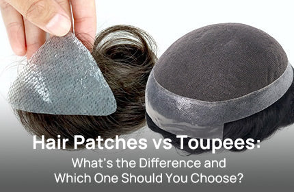 Hair Patches vs Toupees: What’s the Difference and Which One Should You Choose?