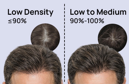 How to Choose the Right Hair Density for You