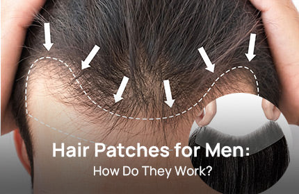 Hair Patches for Men: How Do They Work?