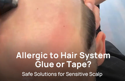 Allergic to Hair System Glue or Tape? Safe Solutions for Sensitive Scalp