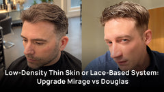 Low-Density Thin Skin or Lace-Based System: Upgrade Mirage vs Douglas