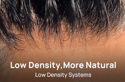 Low Density Hair Systems: Designed for a More Natural Look & Feather-Light Comfort