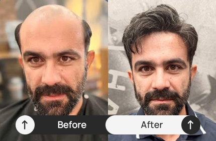 How to Choose the Right Hair Color for Your Hair System: A Complete Guide