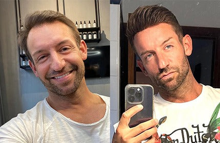 Beginner’s Guide to Hair System Care: Tips for Men to Keep Your Hair System Looking Natura