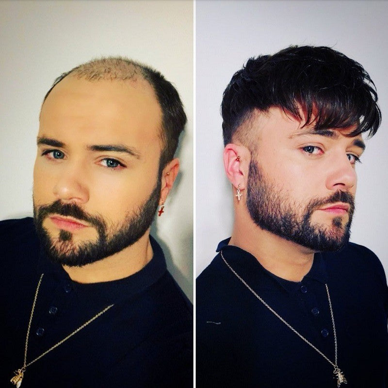 Oceanus Men's Hair System Online | Lace Front with Skin in the Back | Durable Style