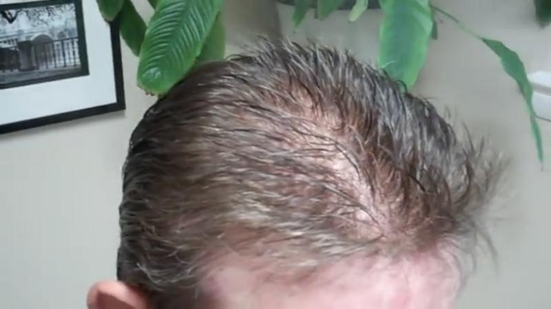 Custom Made Men's Hair System