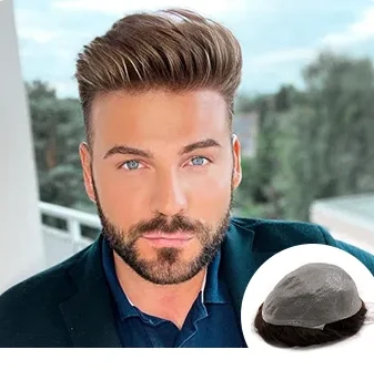 TP1804 - Upgrade Mirage