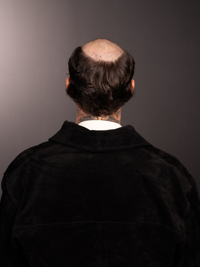Before wearing hair system