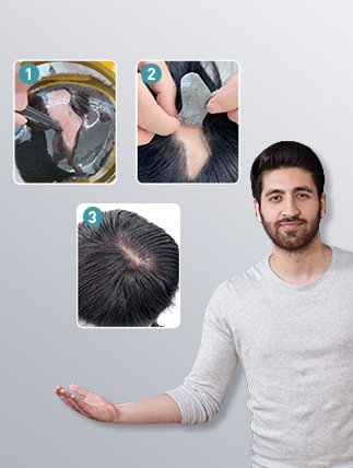 Hair Patch