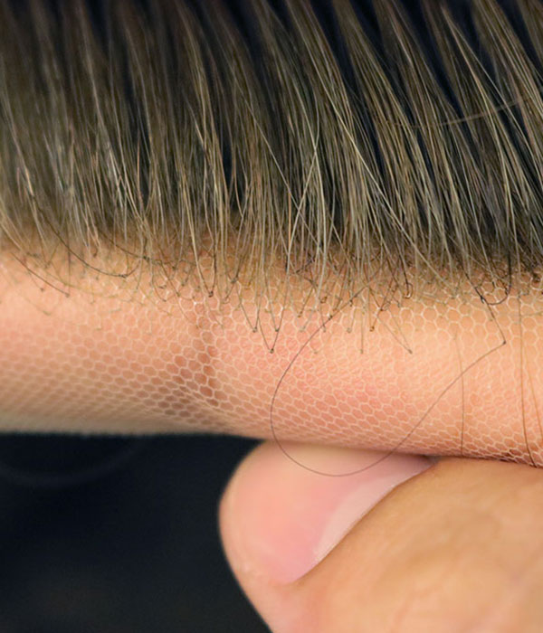 front lace hair system