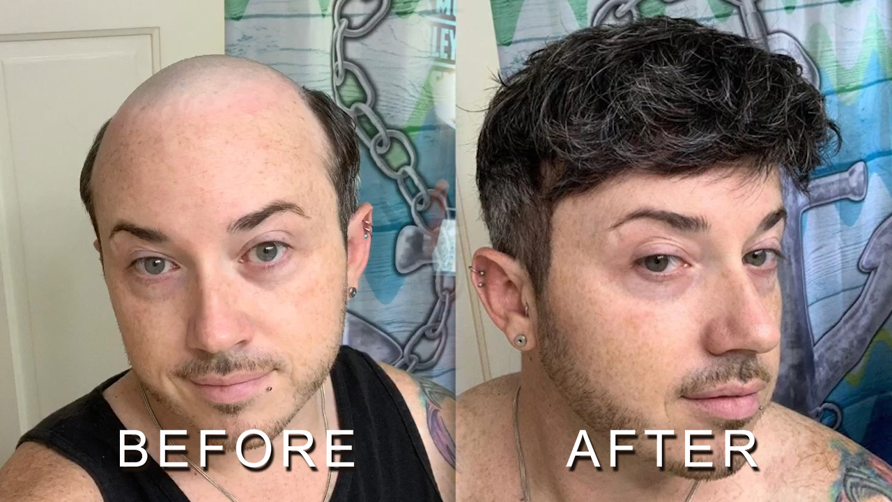 men hair tpupee