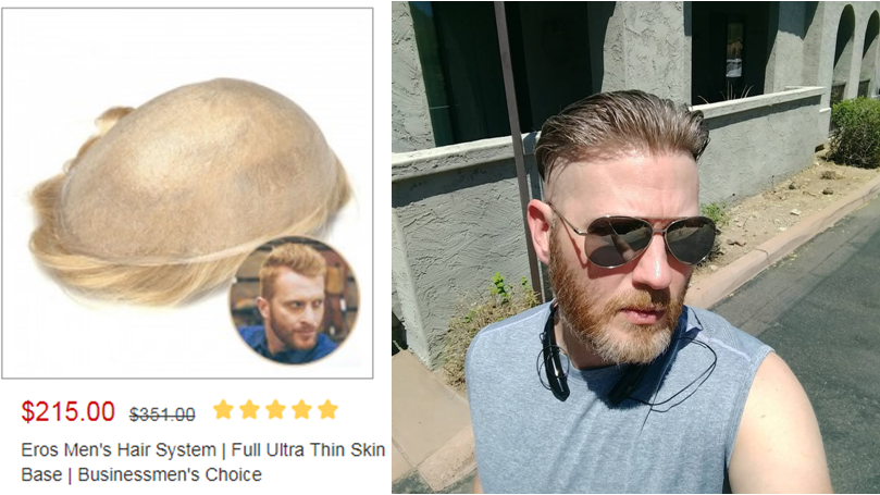 skin hair system