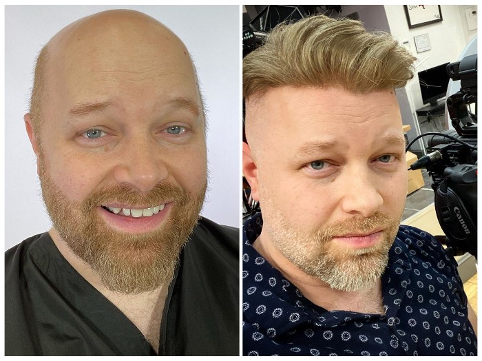 hair sytle for hair system