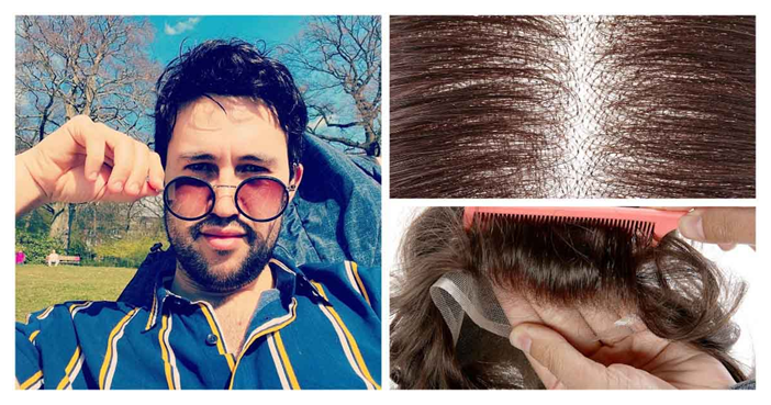 hair thinning at crown male