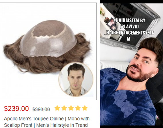 apollo hair system