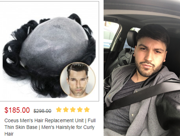 non surgical hair replacement
