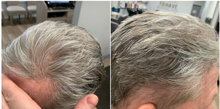 men's hair pieces
