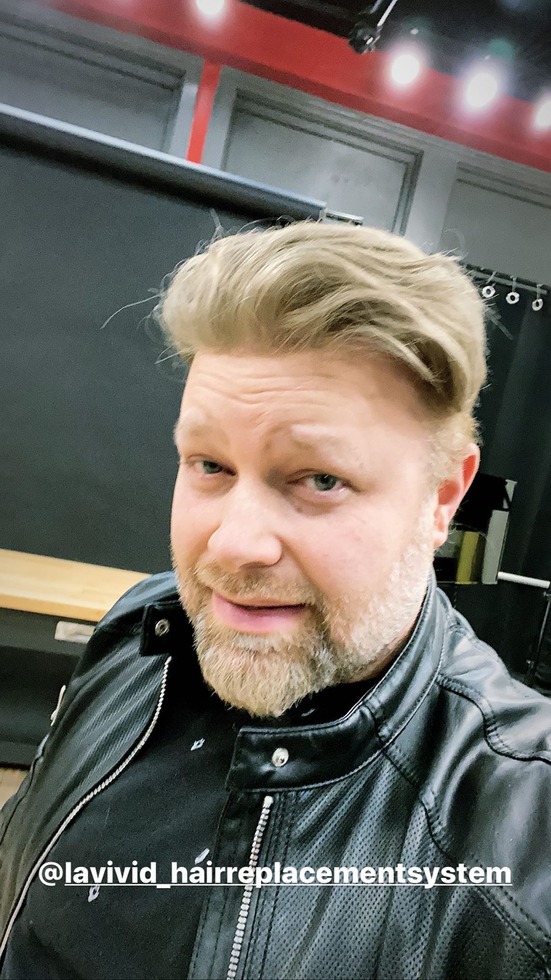 The Reason for High Hair Club Prices The Reason for High Hair Club Prices