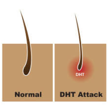 hair follicle