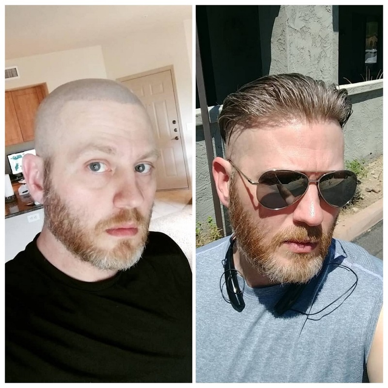 eros hair system