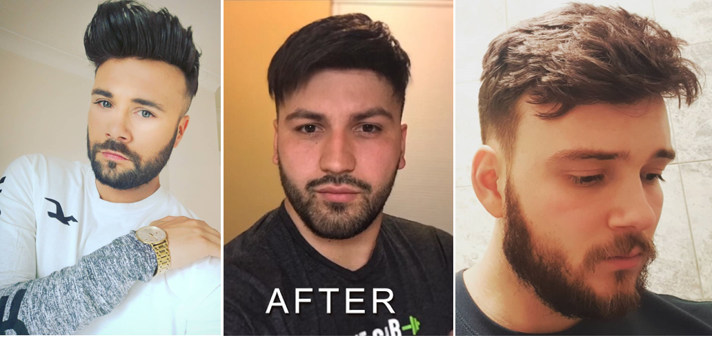 men's toupee glue on