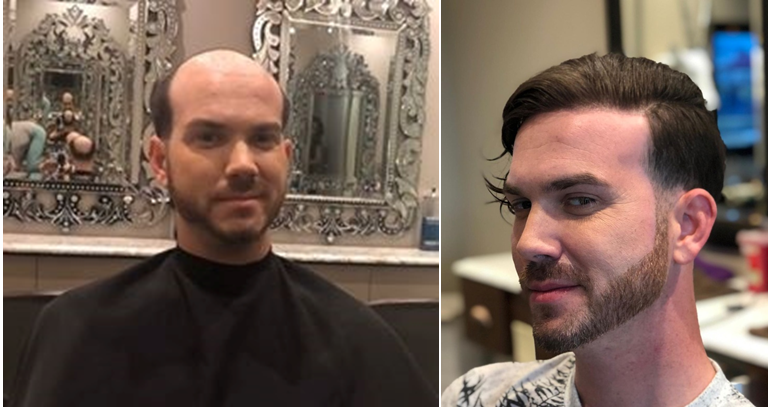 men's hair system