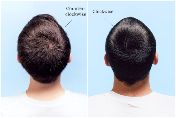 hair whorl