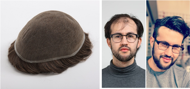 lace toupee