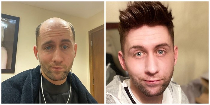 hair sytle for hair system