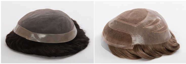 mono hair systems
