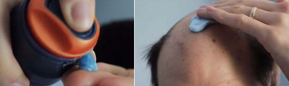 apply scalp protector