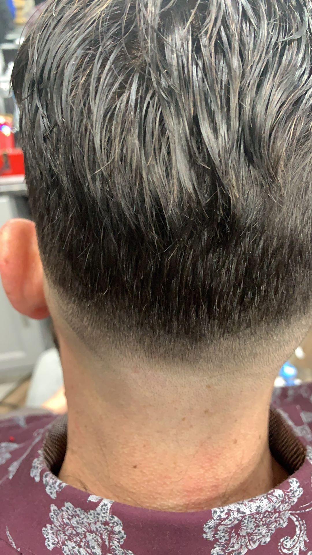 How Do You Feel about Hair Replacement Systems? How Do You Feel about Hair Replacement Systems?