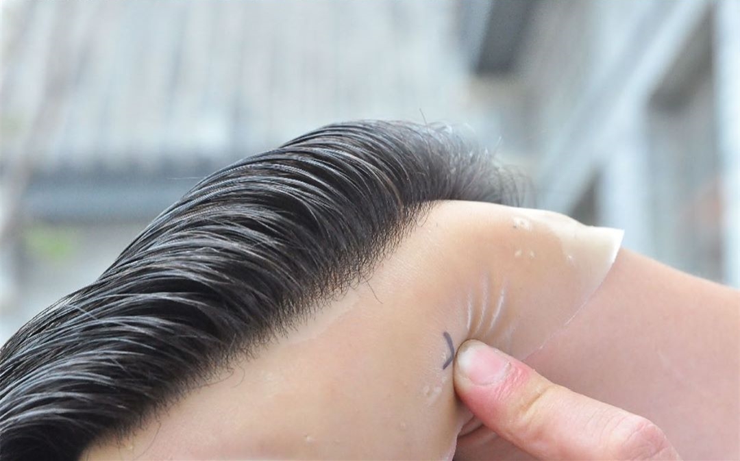 skin toupee