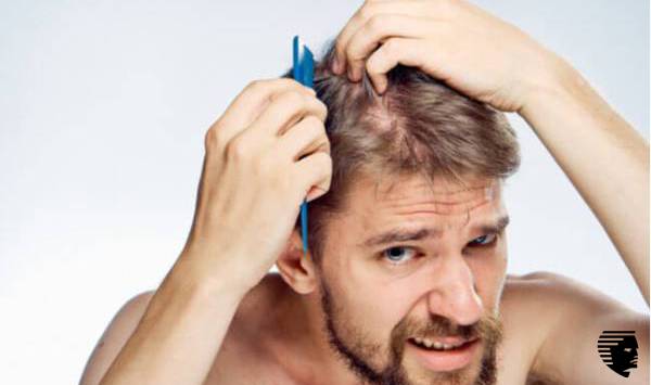 thin hair