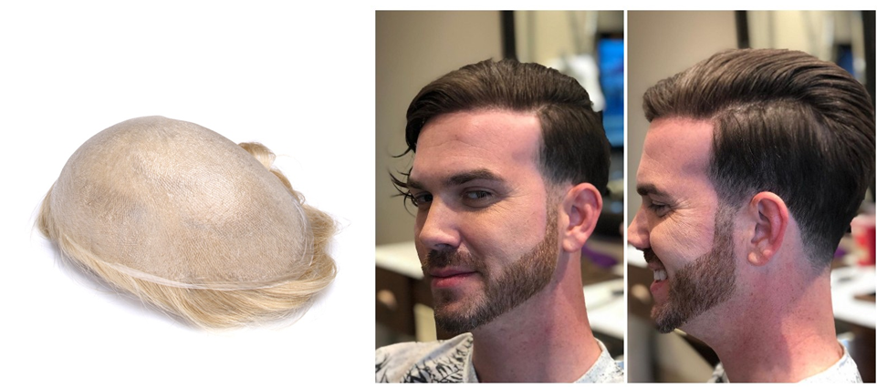 Skin hair toupee