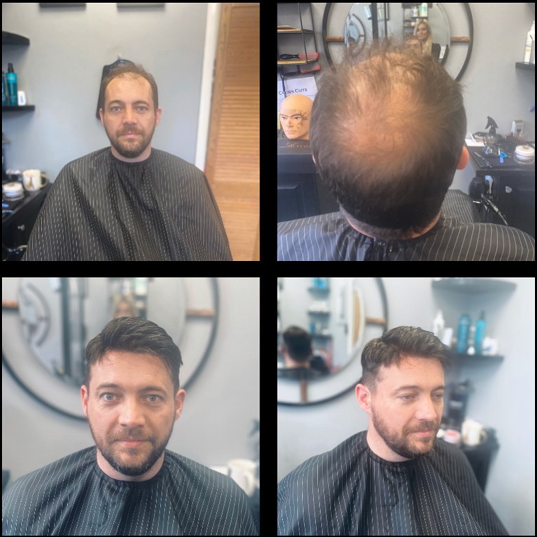 lavivid hair system transformation