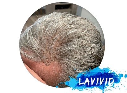 Differentiate Four Similar Men’s Hair Pieces