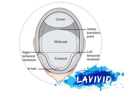Special Techniques Make LaVivid Hair System Special - Hair Directions
