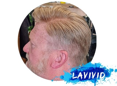 Does Steve Savard Wear a Hairpiece?