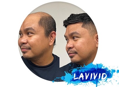 Longevity Tips: Hair System Maintenance Techniques