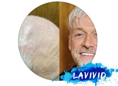 Debunking 5 Common Myths About Men's Hair Systems