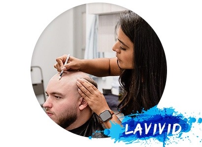 Avoid These Hair System Mistakes for a Natural Look