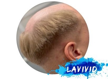 Steps to Make Your Men's Hair Pieces Match with Your Natural Hair Color