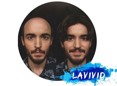 The Real Pros and Cons of Toupees for Men
