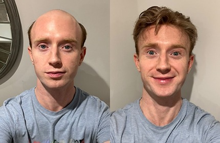 Where the “Fake Hair” Stereotype Comes From