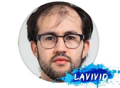 What's the Influence of Hair Loss Pills?