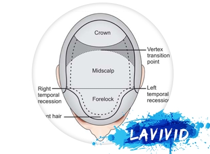 Have You Tried the Black Male Hair Thinning Treatment?